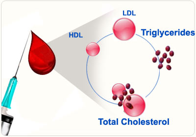 Lipid-Profile-Screening.jpg